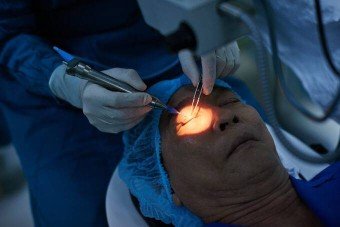 surgery-for-cataracts-img